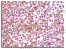 Валидация AntibodySystem RHE22004