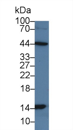 14282