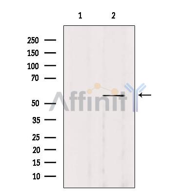 Валидация Affinity DF4618 - 16247