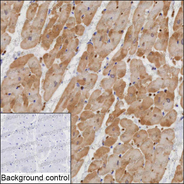Валидация AntibodySystem RHA27401
