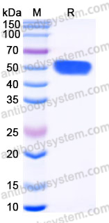 EHJ05902, SDS-PAGE