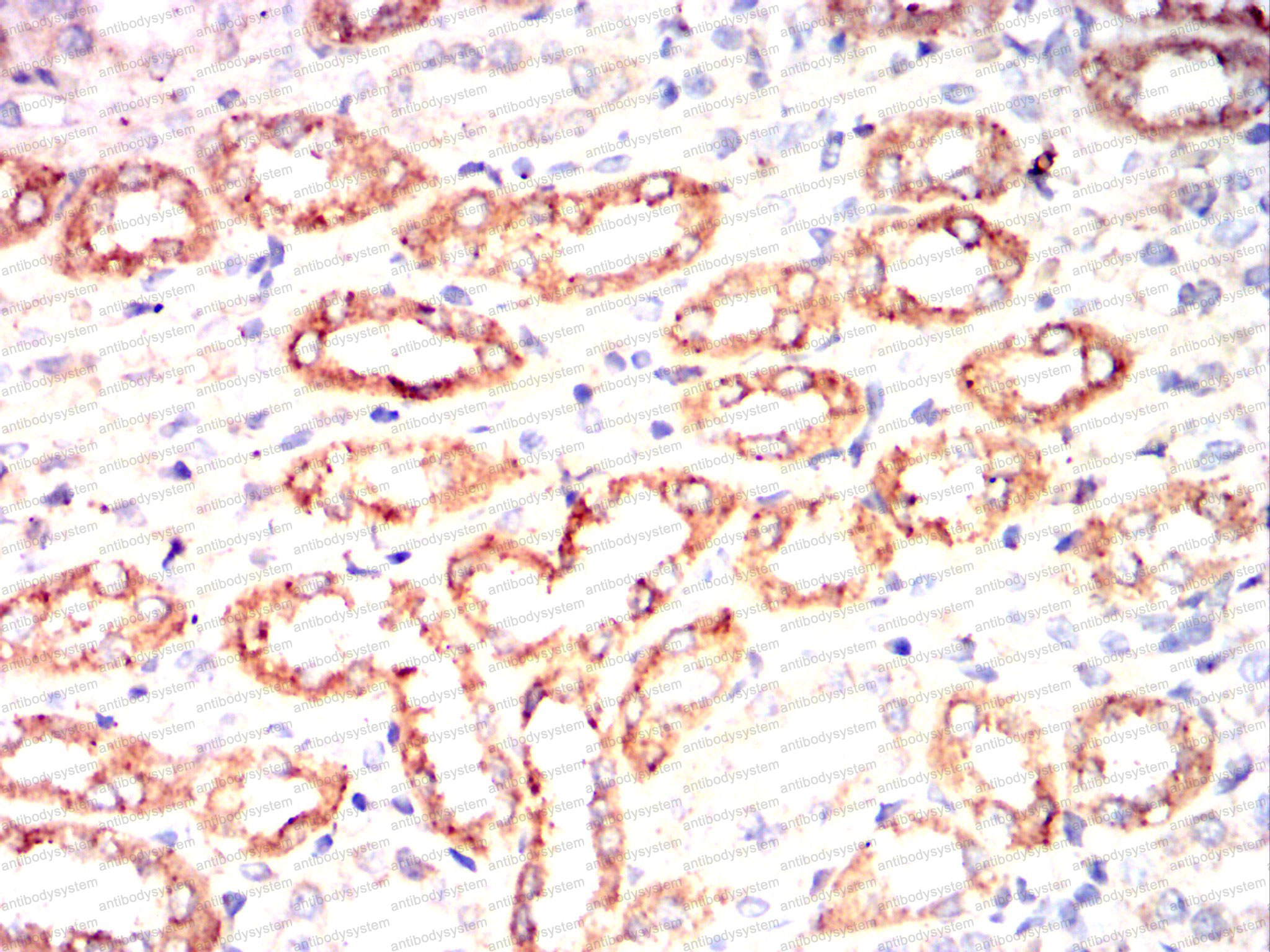 Валидация AntibodySystem RHE18301