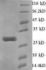 SDS-PAGE