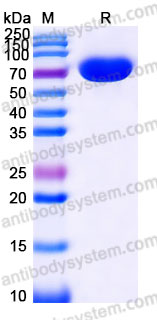 AHJ21602, SDS-PAGE
