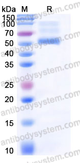 EHJ35103, SDS-PAGE