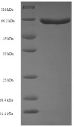 SDS-PAGE