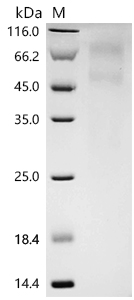 SDS-PAGE