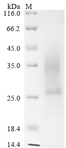SDS-PAGE