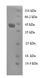 SDS-PAGE