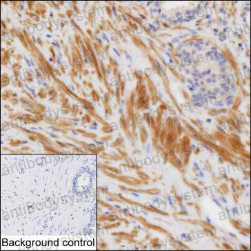 Валидация AntibodySystem RHF60601