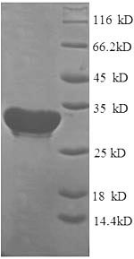 SDS-PAGE
