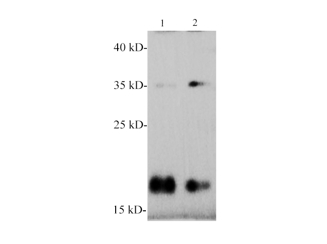 Вестерн-блоттинг, α-Synuclein, ткань мозга мыши и крысы