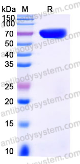 EHJ48502, SDS-PAGE