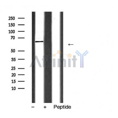 Валидация Affinity AF5392 - 3030