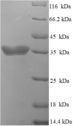 SDS-PAGE