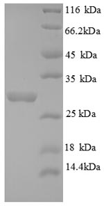 SDS-PAGE