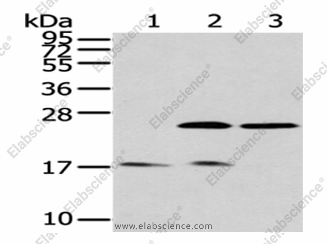 Вестерн-блоттинг, PDPN, ткань мозга плода человека и клетки HeLa, 293T