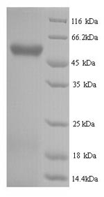 SDS-PAGE