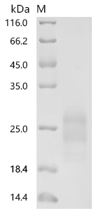 SDS-PAGE