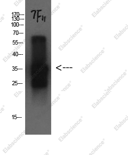 Вестерн-блоттинг, Cystatin C, белок