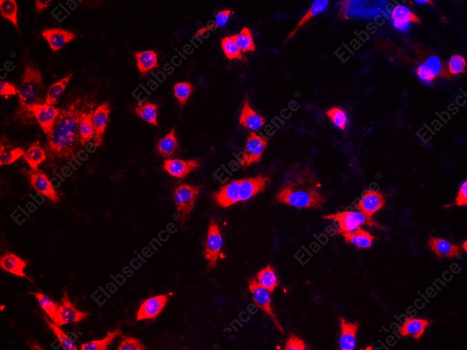 Иммунофлуоресценция, DNA-RNA hybrid, клетки HeLa