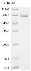 SDS-PAGE