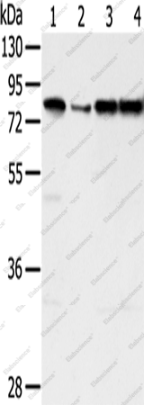 Вестерн-блоттинг, TAF15, клетки Jurkat, HepG2, Raji и A431