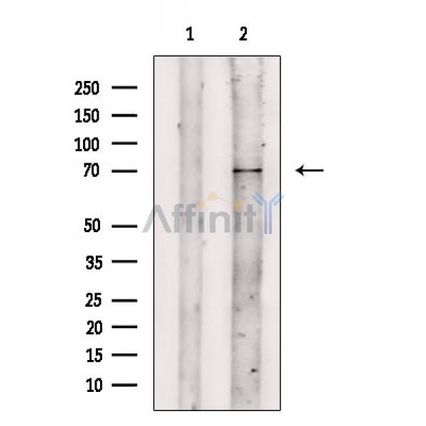 Валидация Affinity DF2535 - 13195