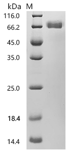 SDS-PAGE