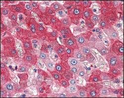 Валидация AntibodySystem RHD51902