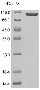 SDS-PAGE