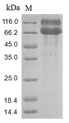 SDS-PAGE