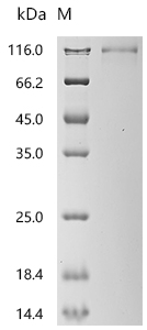 SDS-PAGE