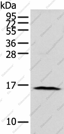 Вестерн-блоттинг, NUDT10, клетки 293T