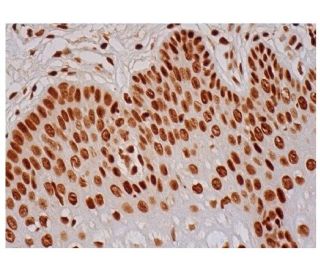 Валидация AssayVector ARM1618(1715)