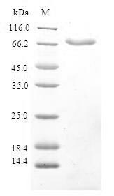 SDS-PAGE