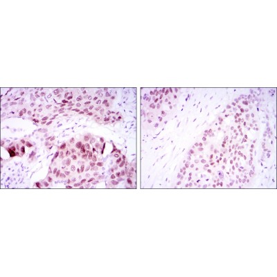 Валидация Affinity BF0481 - 5273