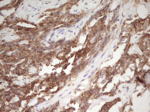 Валидация AssayVector ARM1704(1986)