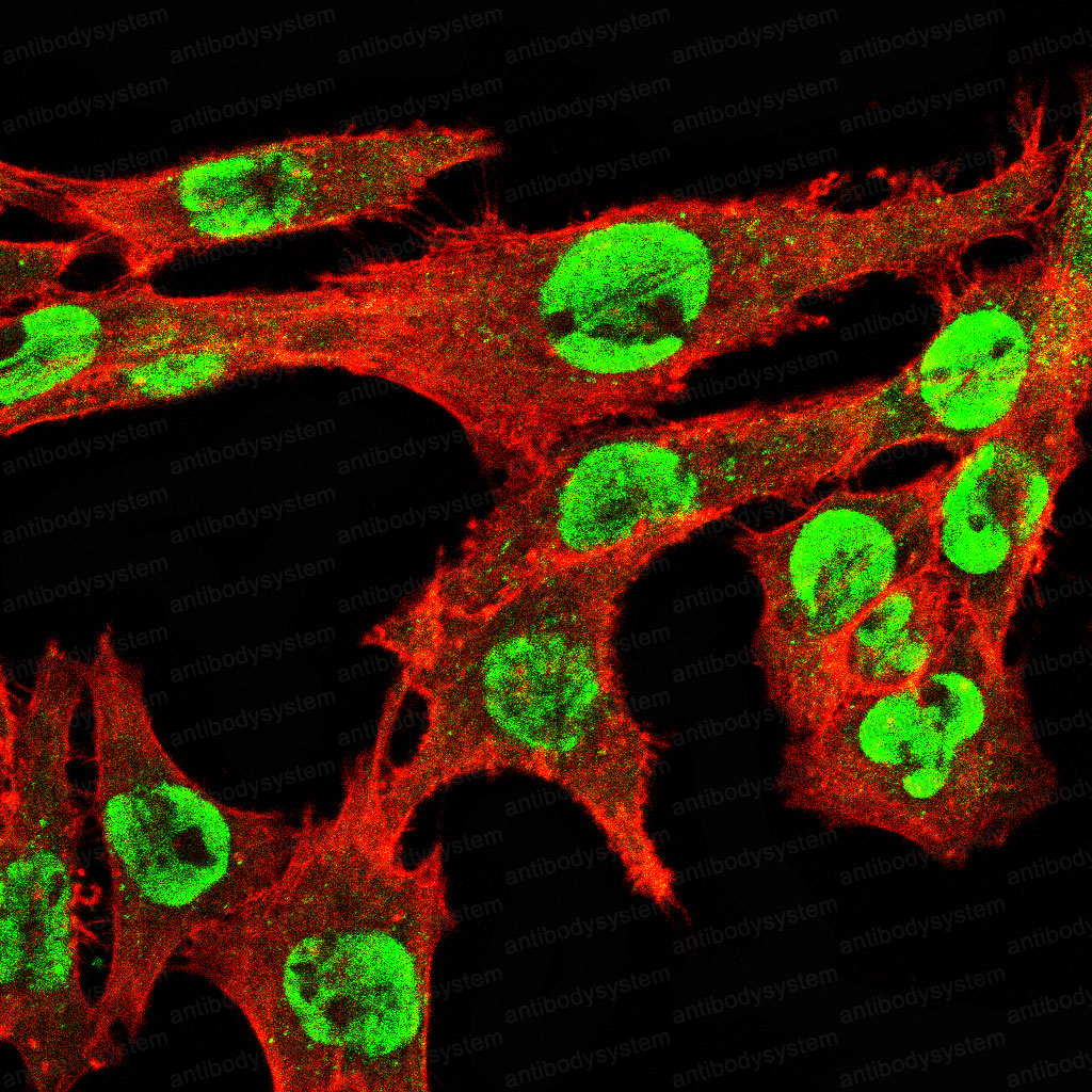Валидация IF - AntibodySystem RHC03209