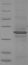 SDS-PAGE