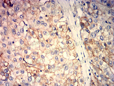 Валидация AntibodySystem RHM00303