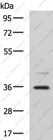 Вестерн-блоттинг, UBLCP1, клетки A172