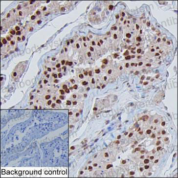 Валидация AntibodySystem RHB82203