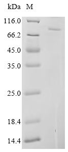 SDS-PAGE