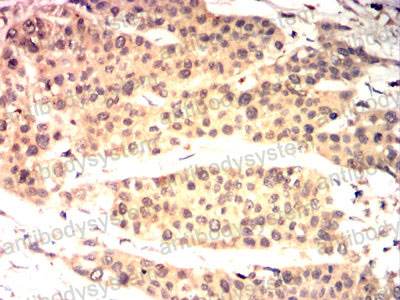 Валидация AntibodySystem RHJ47103