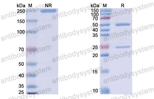Валидация SDS-PAGE - AntibodySystem DHJ28413
