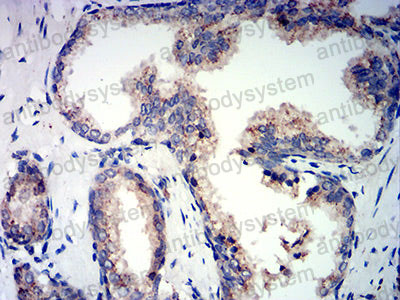Валидация AntibodySystem RHC27103