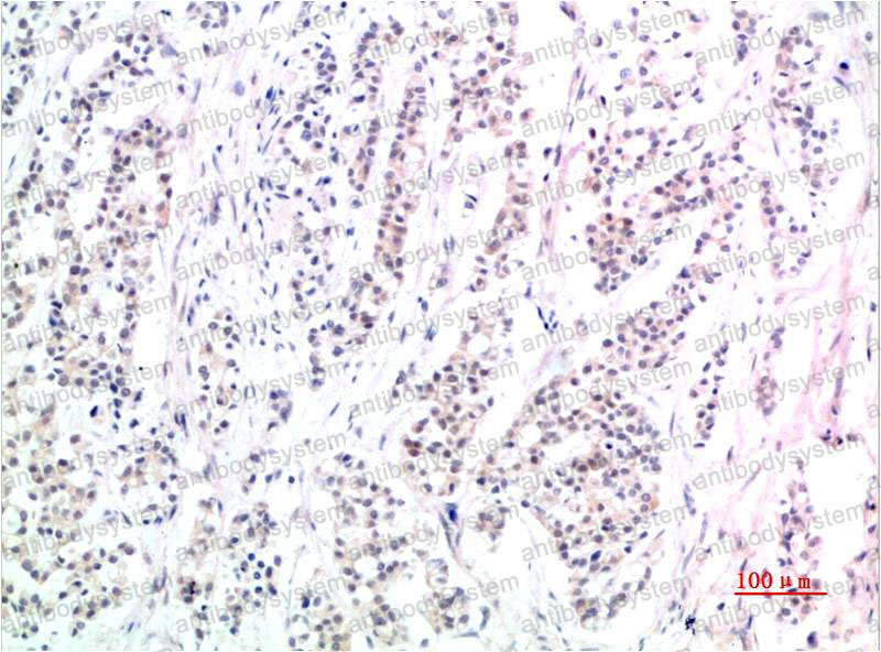 Валидация AntibodySystem RHF75507