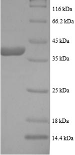 SDS-PAGE