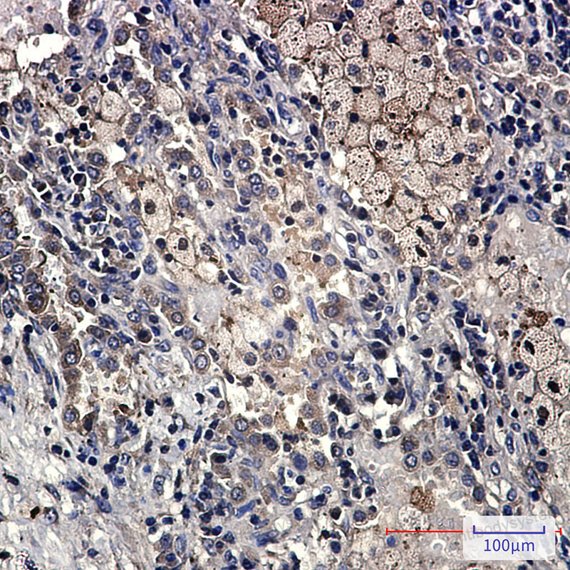 Валидация AntibodySystem RHJ73002